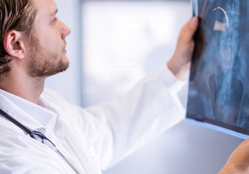 male-doctor-examining-x-ray-in-corridor-2023-11-27-05-07-50-utc_crop.jpg